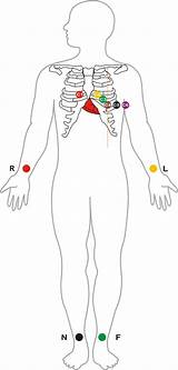Lead ECG Cable/Electrode Three(3),Five(5),Ten(10)