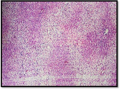 Fig. 8: CCl 4 treated group