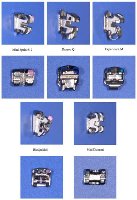 Compressive Strength Comparison of Different Orthodontic Metal Bracket Systems