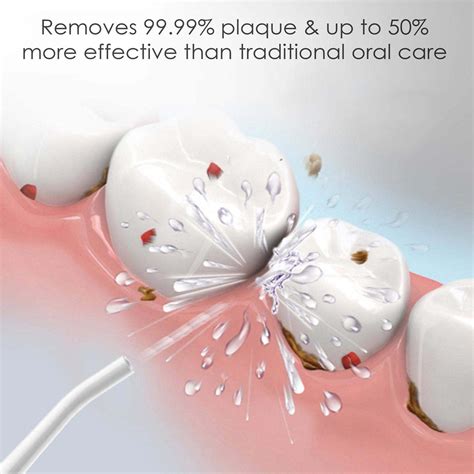 Oral Irrigator Nozzle Tip Ultra Ultra Plus 5Pcs | best branded oral ...