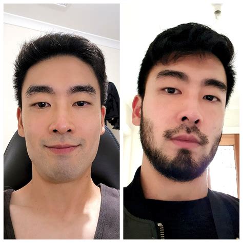 Korean Facial Hair