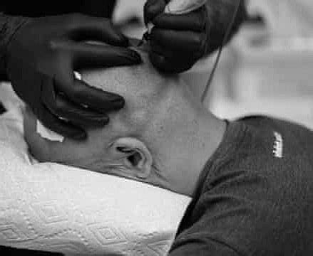 SIR SCALP PHUKET - SMP BOUTIQUE CLINIC/HAIR TATTOO PATONG (2026) All ...