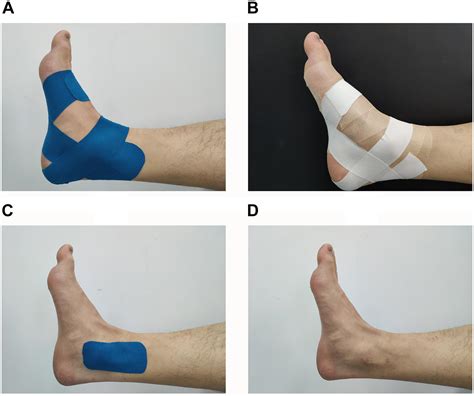 Ankle Instability