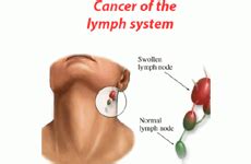 BEST HEAD & NECK DOCTOR | ALEKHYA ENT CARE