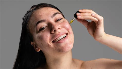 Vitamin C for Dark Spots & Even Skin Tone – Skincare Stem