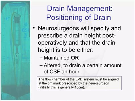 External Ventricular Drain | PPT