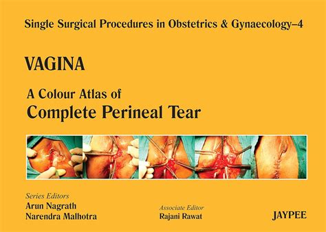 Single Surgical Procedures in Obstetrics and Gynaecology-04: Vagina-A Colour Atlas of Perineal ...