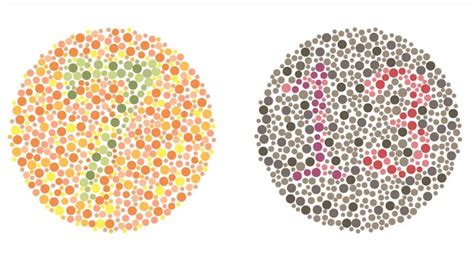 Image result for Colour Vision Deficiency Causes
