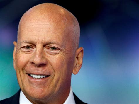 What’s frontotemporal dementia? A look at Bruce Willis’ diagnosis ...