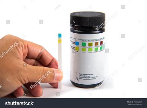 Urine Strip Test For Glucose at John Cargill blog