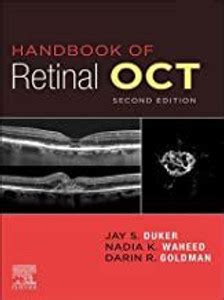 Handbook of Retinal OCT: Optical Coherence Tomography: Buy Handbook of ...