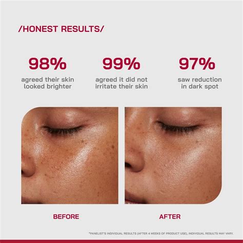 10% Vitamin C Brightening Serum for Dark Spots & Glow | All Skin Types