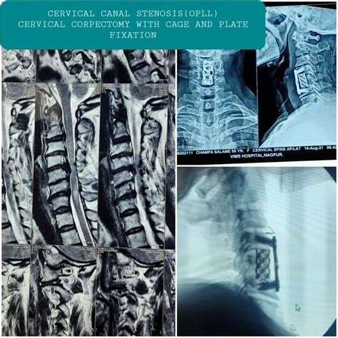 Photo Gallery - Dr Vivek Agrawal