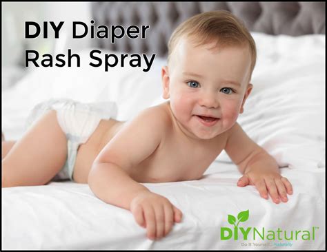 A Simple and Natural Homemade Diaper Rash Spray | Diaper rash, Natural ...