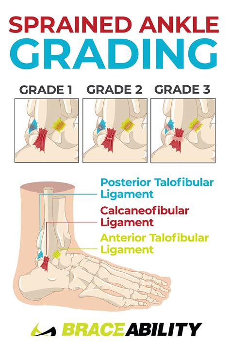 Ankle sprains recovery – Artofit
