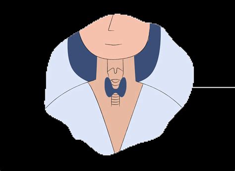 What is Hashimoto's Thyroiditis? | Paloma Health