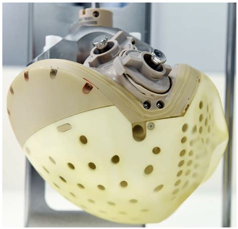 The Total Artificial Heart: A Historical Perspective