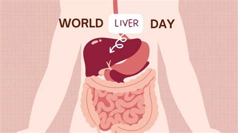 World Liver Day 2024: Excessive Drinking May Lead To Severe Liver ...