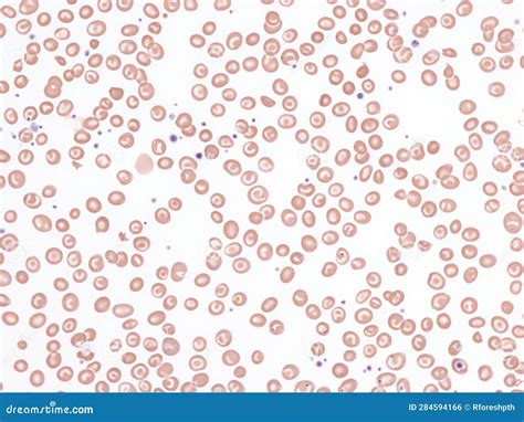 Codocytes. stock photo. Image of target, microscope - 284594166