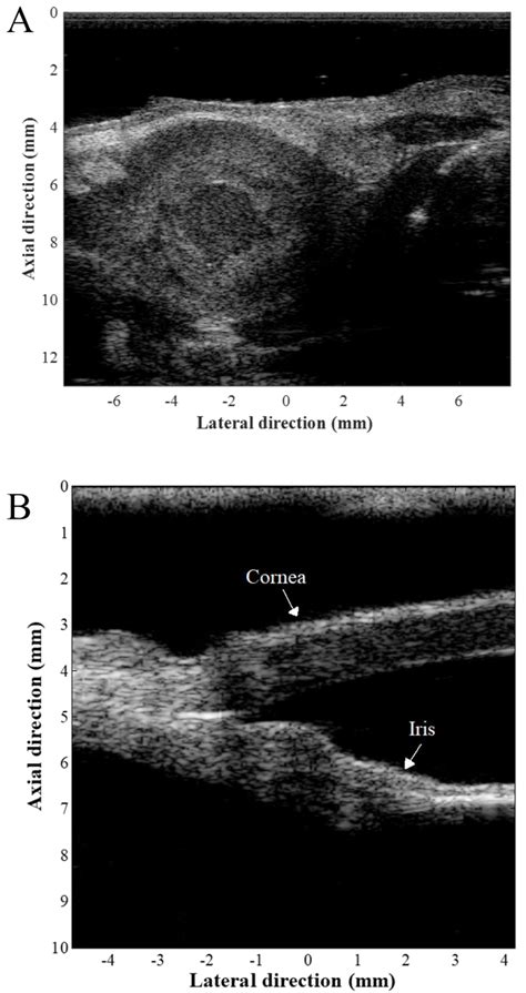 Recent Advancements in High-Frequency Ultrasound Applications from ...