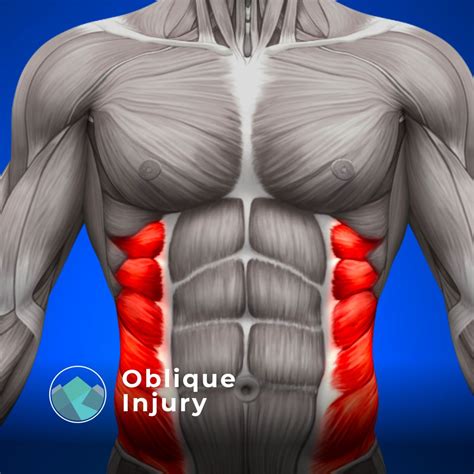 Connected Whole Health on LinkedIn: "🏃‍♂️ Dealing with an oblique ...