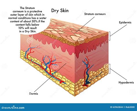 Dry Skin Medical Term