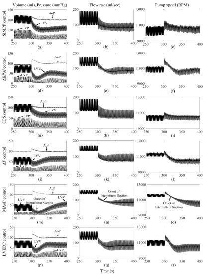A Flow Sensor-Based Suction-Index Control Strategy for Rotary Left ...