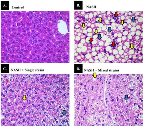 Biomedicines | Special Issue : Advances in Pathogenesis and ...
