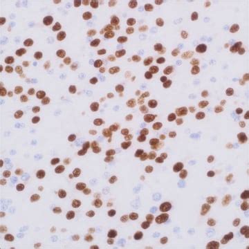 Olig2 (EP112) Rabbit Monoclonal Primary Antibody | Sigma-Aldrich