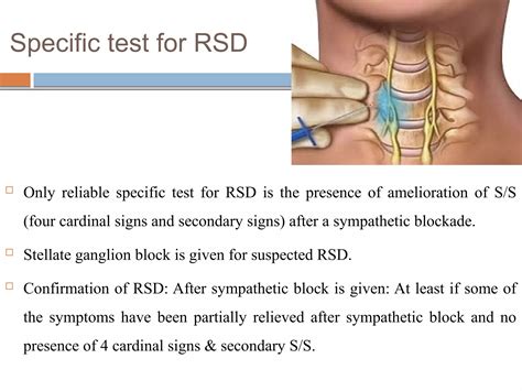 Reflex symapathetic dystrophy | PDF - rsd reflex sympathetic dystrophy symptoms