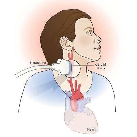 Ultrasound of carotid artery | Battista Illustration