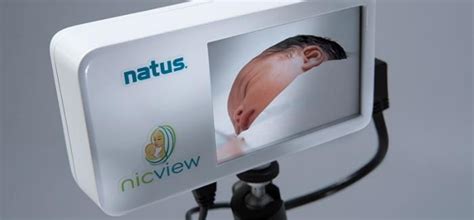 Natus Medical Office Photos