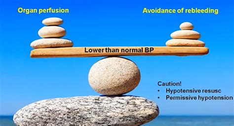 Damage Control Resuscitation | SAKSHAM LMIS - NIHFW