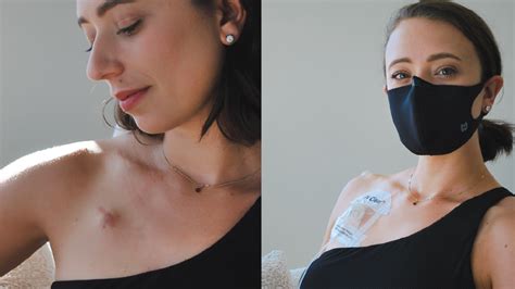 Port 的图像结果