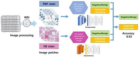 Cancers | Special Issue : Artificial Intelligence in Cancer Screening
