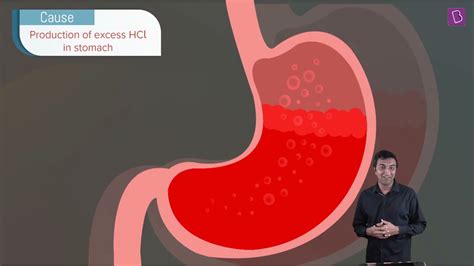 Image result for Science Class 10 Chapter 2