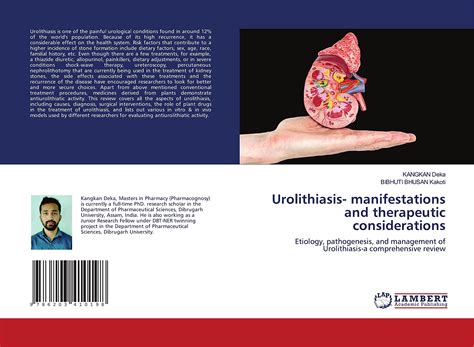 Buy Urolithiasis- manifestations and therapeutic considerations ...