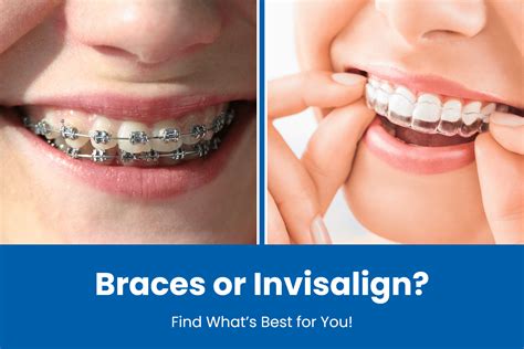 Invisalign vs. Traditional Braces: Which Is Right for You?