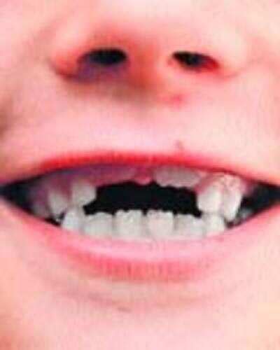 Broke a tooth? Grow another!