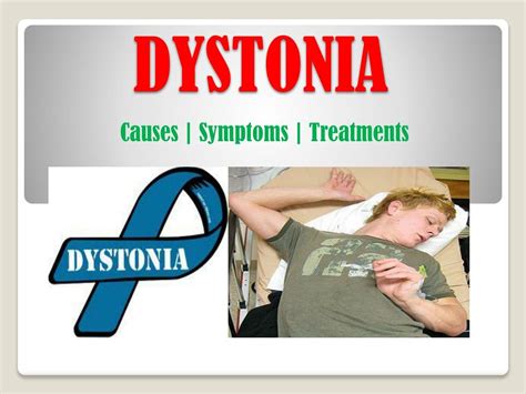 PPT - Dystonia: Symptoms, causes and treatment PowerPoint Presentation - ID:7480883