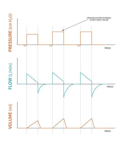 6.7: 6.7 Volume Support Ventilation - Medicine LibreTexts