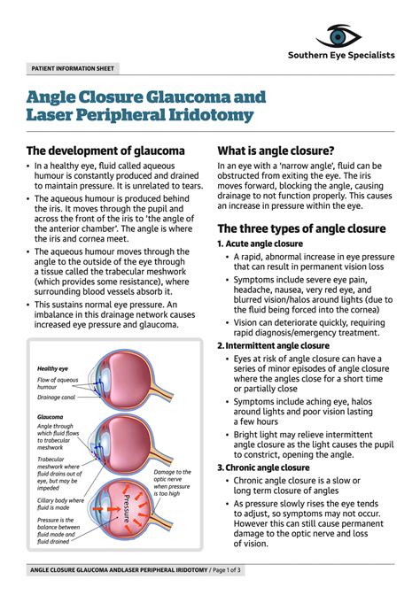 Glaucoma - Southern Eye Specialists