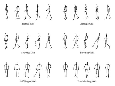 Sensors | Special Issue : Sensor Technologies for Gait Analysis