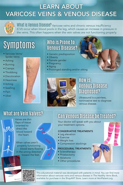 Chronic Venous Insufficiency: Causes, Symptoms And, 41% OFF