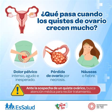 EsSalud Perú on Twitter: "¡Atención! 🚨 Ante la sospecha de un quiste ...