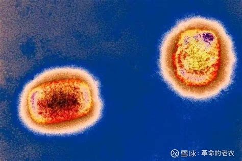 中国大陆出现首例输入确诊猴痘病例 9月16日，重庆市确诊1例境外输入猴痘病例。该病例为中国大陆地区出现的首例输入确诊猴痘病例。因为该患者在按 ...