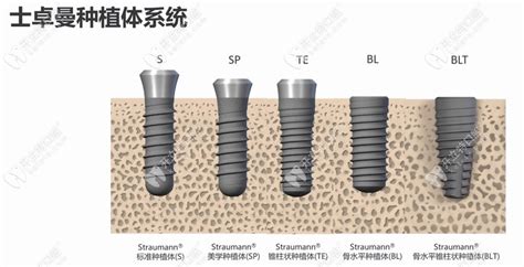 瑞士iti士卓曼blt与瑞锆的区别在哪,从种植体图片上找找,种植牙-8682赴韩整形网