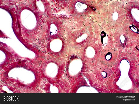 Bone Connective Tissue Under Microscope