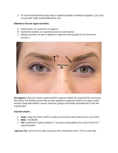 Image result for Botox Tutorial