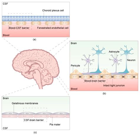 Novel Therapeutic Approaches in Neoplastic Meningitis